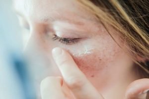 Causes of dry skin around the eyes